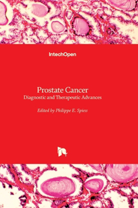 Prostate Cancer