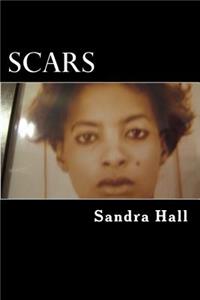 Scars