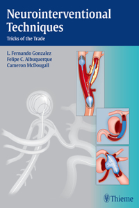 Neurointerventional Techniques