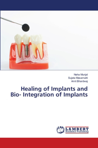 Healing of Implants and Bio- Integration of Implants