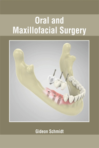 Oral and Maxillofacial Surgery