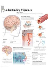 Understanding Migraines Paper Poster