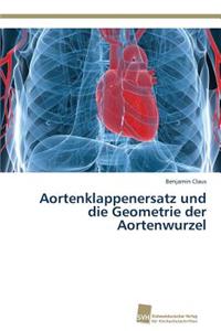 Aortenklappenersatz und die Geometrie der Aortenwurzel