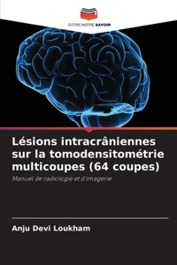 Lésions intracrâniennes sur la tomodensitométrie multicoupes (64 coupes)
