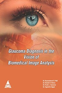 Glaucoma Diagnosis in the Vision of Biomedical Image Analysis