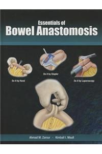 Essentials of Bowel Anastomosis