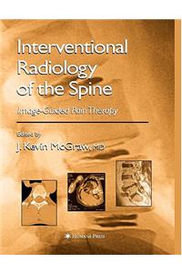 Interventional Radiology of the Spine