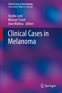 Clinical Cases in Melanoma