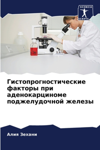 Гистопрогностические факторы при аденок&