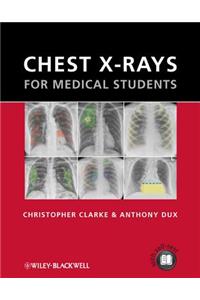 Chest X-Rays for Medical Students