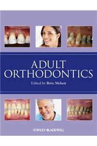 Adult Orthodontics