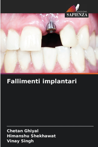 Fallimenti implantari