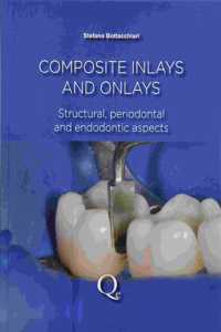 COMPOSITE INLAYS AND ONLAYS STRUCTURAL PERIODONTAL AND ENDODONTICS ASPECTS (HB 2016): Structural, Periodontal, and Endodontic Aspects