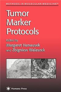 Tumor Marker Protocols