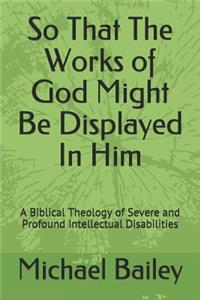 So That the Works of God Might Be Displayed in Him
