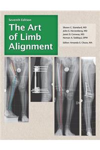The Art of Limb Alignment