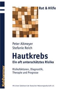 Hautkrebs - Ein Oft Unterschatztes Risiko
