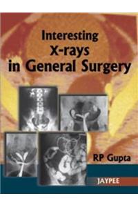 Interesting X-Rays in General Surgery