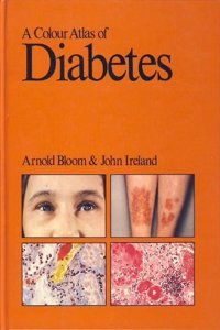 A Colour Atlas of Diabetes