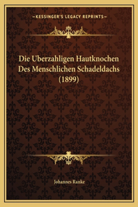 Uberzahligen Hautknochen Des Menschlichen Schadeldachs (1899)