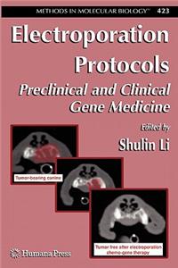 Electroporation Protocols