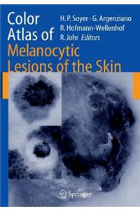 Color Atlas of Melanocytic Lesions of the Skin