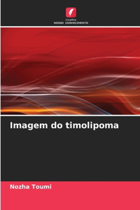 Imagem do timolipoma