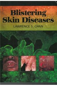 Blistering Skin Diseases