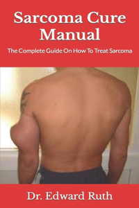 Sarcoma Cure Manual: The Complete Guide On How To Treat Sarcoma