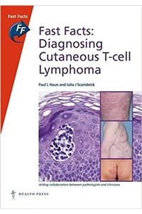 Fast Facts: Diagnosing Cutaneous T-cell Lymphoma