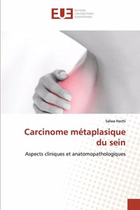 Carcinome métaplasique du sein