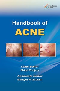 Handbook of Acne