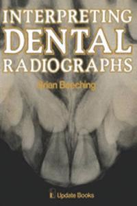 INTERPRETING DENTAL RADIOGRAPHS