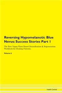 Reversing Hypomelanotic Blue Nevus