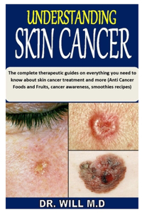 Understanding Skin Cancer