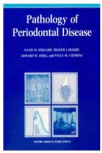 Pathology of Periodontal Disease