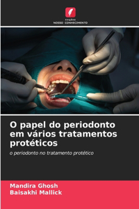 O papel do periodonto em vários tratamentos protéticos