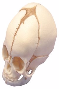 FOETAL SKULL