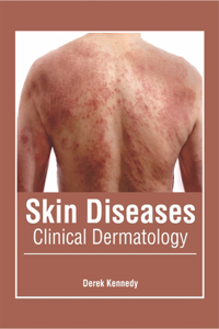 Skin Diseases: Clinical Dermatology