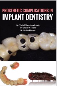 PROSTHETIC COMPLICATIONS IN IMPLANT DENTISTRY