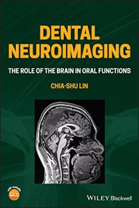 Dental Neuroimaging