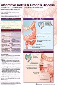 Ulcerative Colitis & Crohn's Disease Anatomical Chart Laminated