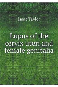 Lupus of the cervix uteri and female genitalia