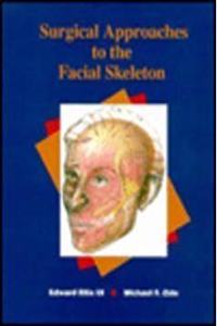 Principles of Internal Fixation of the Craniomaxillofacial Skeleton