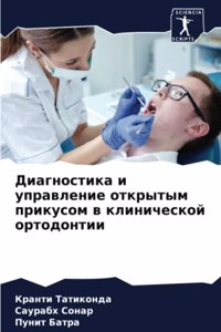 Диагностика и управление открытым прикус