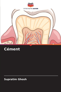 Cément