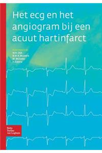 Het ECG En Het Angiogram Bij Een Acuut Hartinfarct