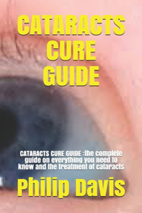 Cataracts Cure Guide