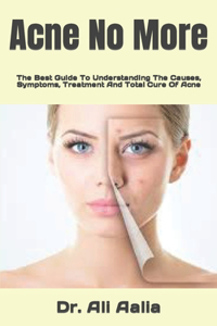 Acne No More
