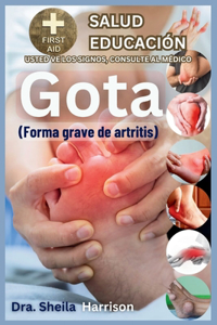 Gota: forma grave de artritis: Causas, Síntomas, Manejo de Modificadores de Riesgo, Tratamiento, MEDICAMENTOS (APROBADOS MUNDIALMENTE), Prevención, Alimen